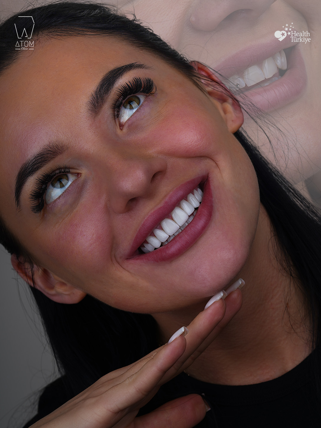 Smile