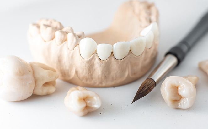 Zirconium Crowns